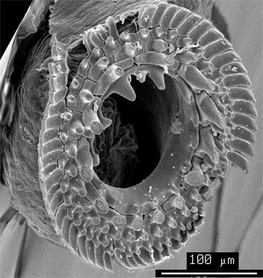 SEM_photograph_of_a_manus_sucker.